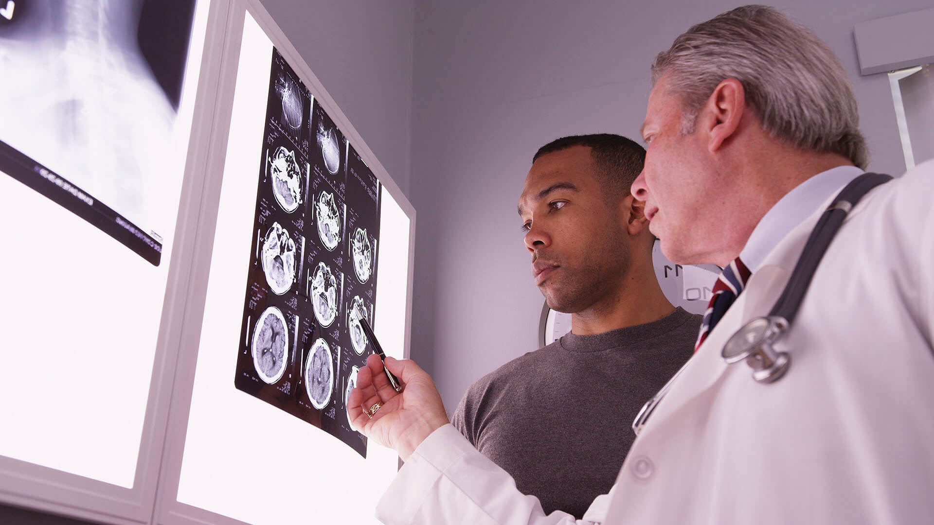 A man looking at an MRI brain scan with his doctor after a concussion